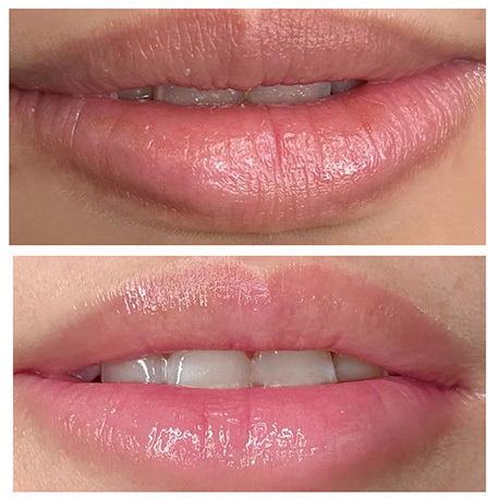 大宮肌育成エステサロン｜しみ・シワ・肝斑でお悩み向け幹細胞培養上清液フェイシャルエステ