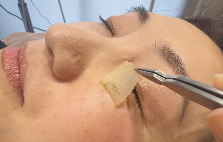 大宮肌育成エステサロン｜しみ・シワ・肝斑でお悩み向け幹細胞培養上清液フェイシャルエステ