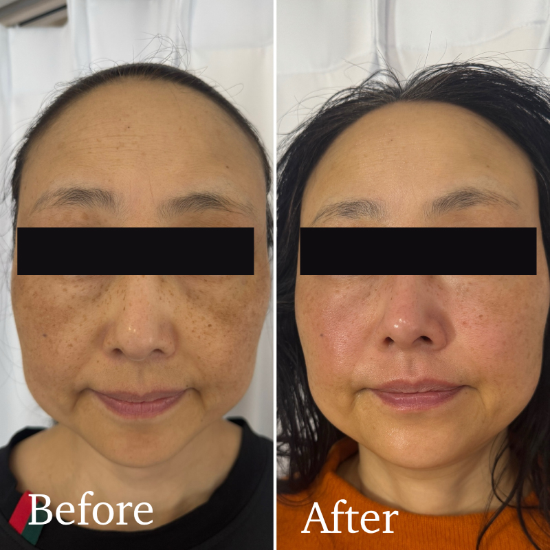 20251228_02_01 - Re:Birth|大宮エステサロン