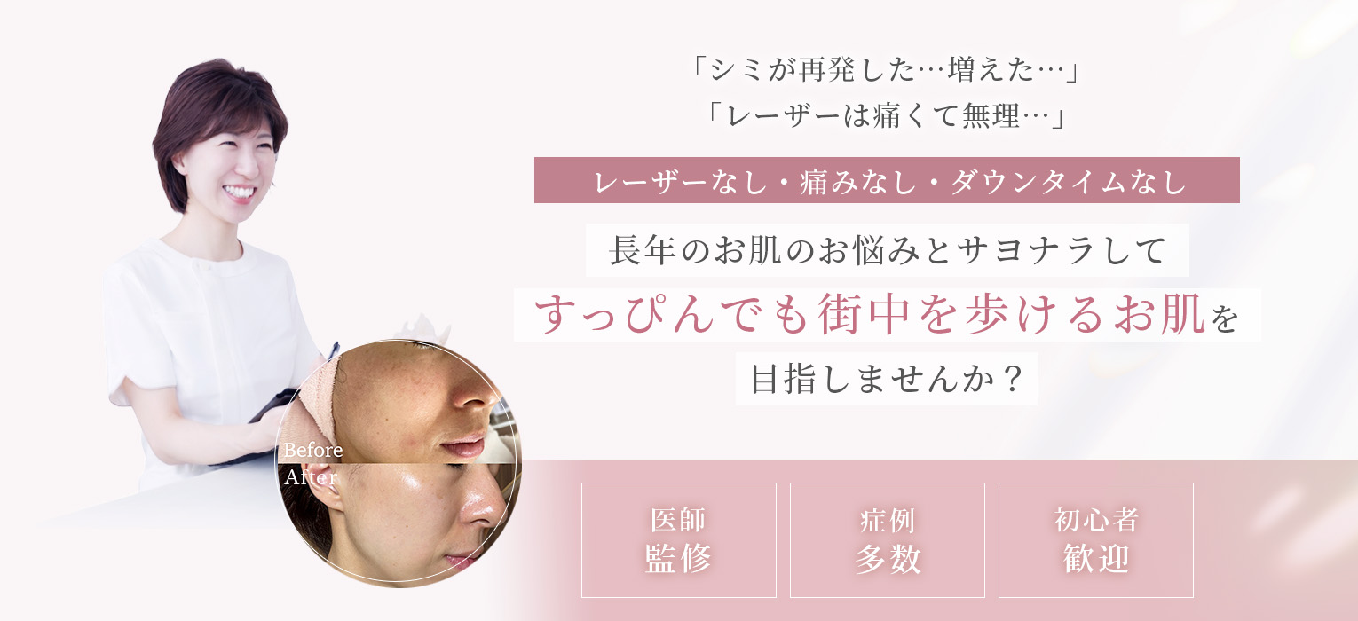 Smiling woman in a white outfit beside a circular Before/After face photo on a pink-themed skincare clinic banner with Japanese text about painless, downtime-free treatment.