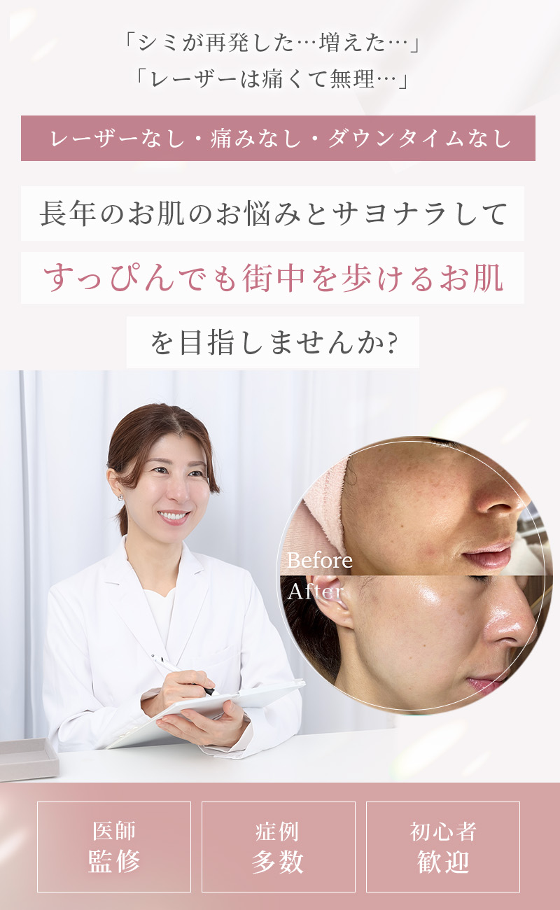 sp_head_202608 - Re:Birth|大宮エステサロン 大宮肌育成エステサロン|しみ・シワ・肝斑でお悩み向け幹細胞培養上清液フェイシャルエステ
